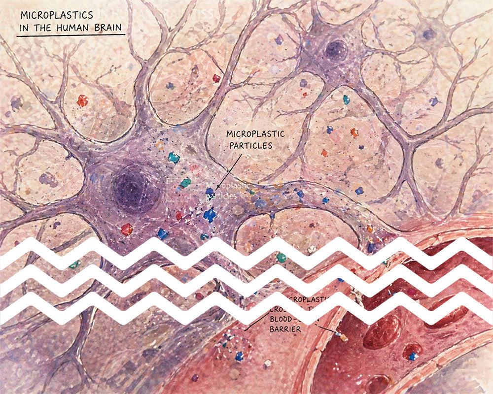 Microplastics in the human brain: What new research reveals