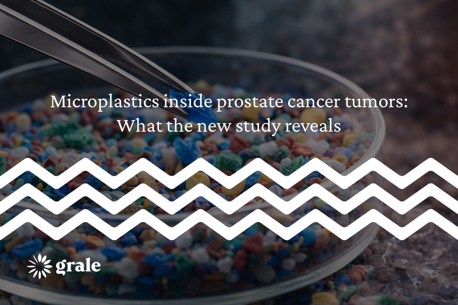 Microplastics inside prostate cancer tumors: What the new study reveals