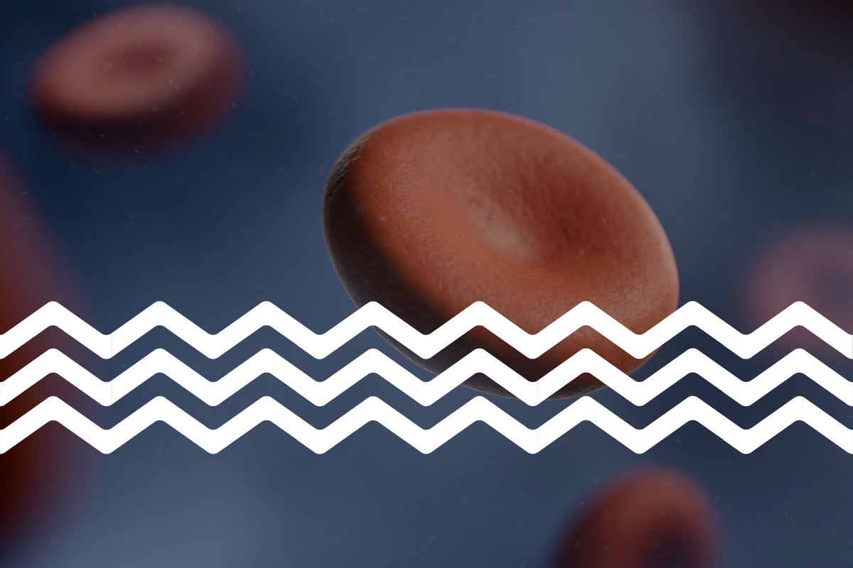 Microplastics found inside human blood clots